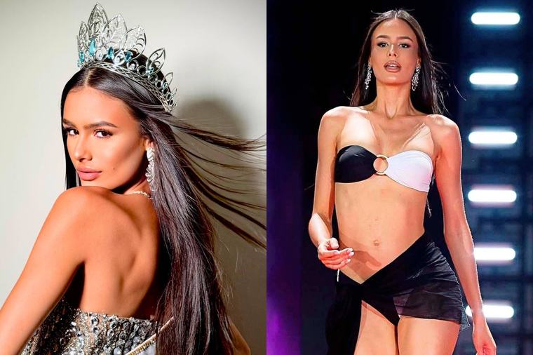 Miss que foi destronada após revelar gravidez é internada no Espírito Santo